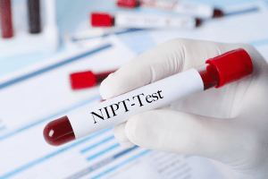 NIPT test 9w